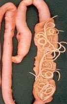 spoelwormen