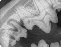 dentale röntgenfoto